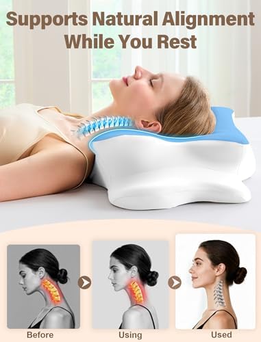 Cervical Neck Pillow for Pain Relief – Ergonomic Memory Foam Pillow for Side Sleeper Contour Orthopedic Bed Pillow for Neck Support with Cooling Cover – Ideal Christmas Birthday Gift for Women -Blue