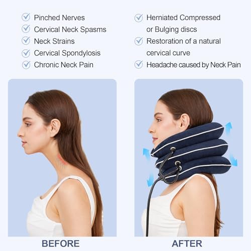 Neck Stretcher for Pain Relief, Adjustable Inflatable Cervical Traction Device, Neck Brace for Home Use, Supports Neck Decompression & Spine Alignment，Gifts for Women (Sky Blue)