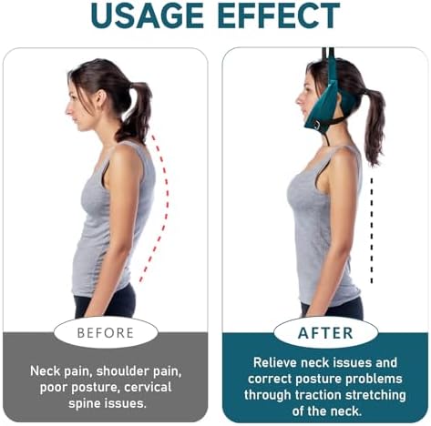 2026 New Upgraded Cervical Neck Traction Device,Neck Stretcher Cervical Traction Device for Decompression Home Physical Therapy, Portable Neck Stretcher Hammock Traction