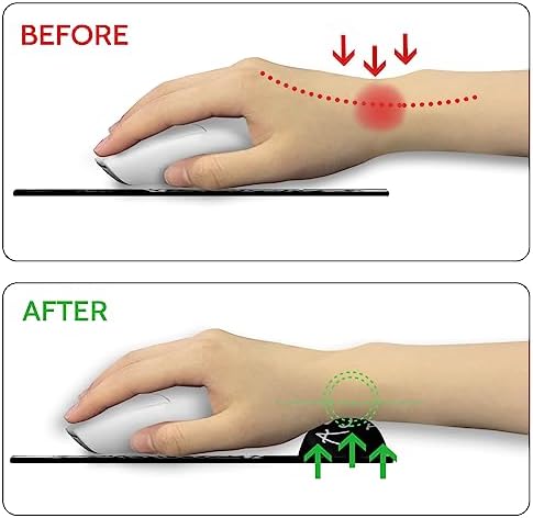 Blusabaca Skeleton Ergonomic Mouse Pad Wrist Rest Mousepad Wrist Support