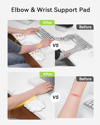 Elbow Pad for Desk, 2-Pack Cloud Elbow Rest(White), Edge Arm Rest