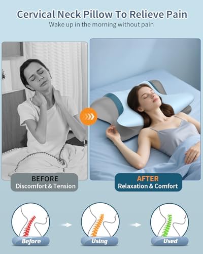 Cervical Pillow for Neck Pain Relief, Ergonomic Neck Pillow for Sleeping, Orthopedic Contour Side Sleeper Pillow for Neck Support, Memory Foam Pillows for Back Stomach Sleepers (Light Blue)