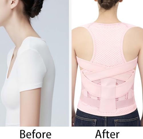Back Brace Posture Corrector for Women and Men Adjustable Shoulder Straightener Helps Reduce Upper Lower Back Pain Relief Support Hump Scoliosis Hunchback Slouching Kyphosis Traction Correction Syste Pink X-Large