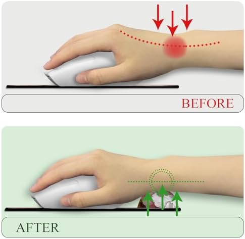 LIMKRIAN Black Flower Ergonomic Mouse Pad with Wrist Rest, 9.8 x 8.6 in