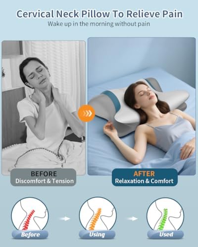 Pain Relief Cervical Neck Pillow, Ergonomic Contour | Q-Max Cooling | Non-Temperature Memory Foam | Side/Back/Stomach Sleeper Support for Sleeping, Reading, Scrolling (Silvergrey)