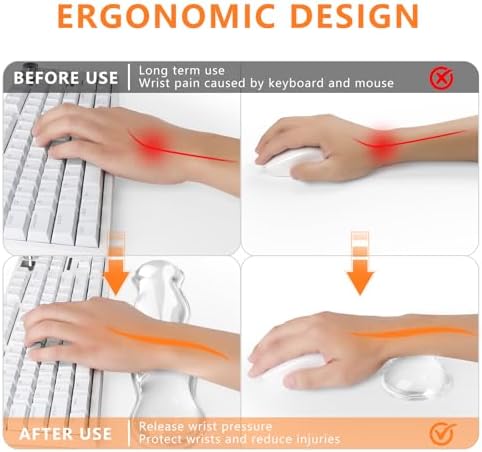 Gel Keyboard Wrist Rest, Cute Wrist Support and Arm Support Keyboard Rest for Keyboard and Mouse Typing Pain Relief，Suitable for Office/Computer/Laptop/Gaming（Transparent White Set ）