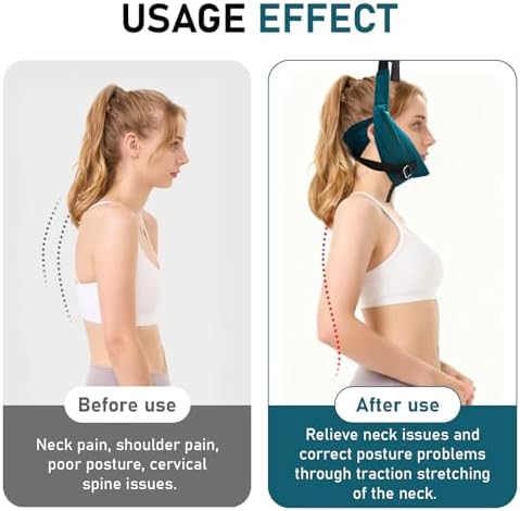 Cervical Neck Traction Device Over Door for Home Use Portable Neck Stretcher Hammock Decompression Home Physical Therapy (Blue)3