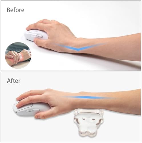 Ergonomic Gel Mouse Wrist Rest,Clear Cute Rabbit Mouse Wrist Rest