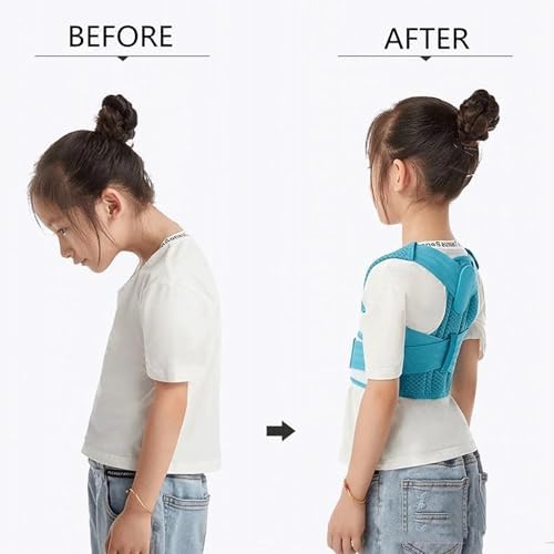 Back Brace Posture Corrector Kid Teenagers,Adjustable Upper Back Straightener Lumbar Support Belt for Hunchback Correction Pain Relief,Breathable Spine Support Brace Spine Corrector