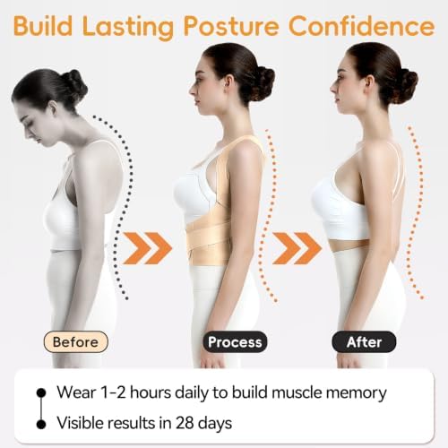 babaka Posture Corrector for Women, Invisible Lightweight Adjustable Back Brace for Upper and Lower Back Pain Relief, Hunchback, Hump, Scoliosis, Thoracic, Spine Corrector Under Clothes (Beige, Small, Waist: 25''-30'')