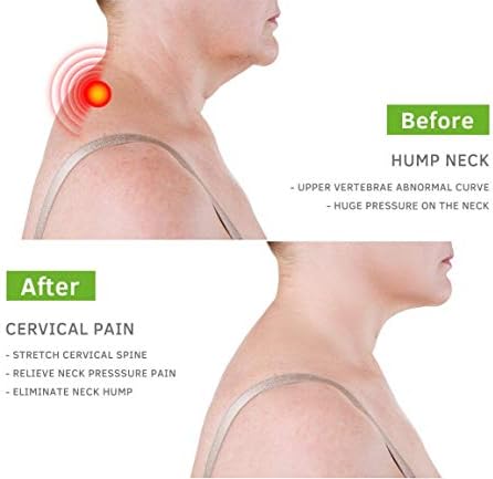BEIBYE- Upper Back and Headache Pain Relief - treatment for Costochondritis and Tietze Syndromeb-Help Back Stretcher, Posture Corrector