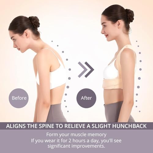 JMPOSE Back Posture Corrector for Women: Adjustable Shoulder Posture Brace Straightener Pain Relief (Beige L/XL)