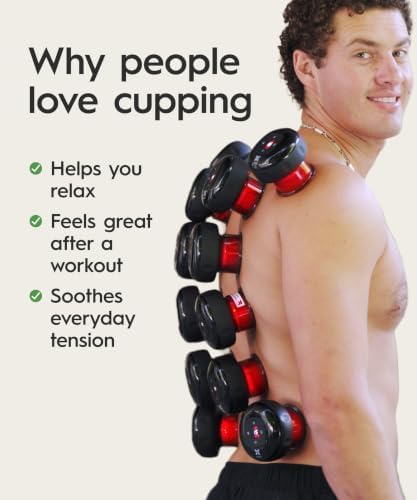 REVOMADIC REVO The Original 4-in-1 Smart Cupping Massager with LED Light, Heat, Dynamic Suction & Vibration Massage, Portable Cordless Rechargeable Cupping Device for Body-2 Pack