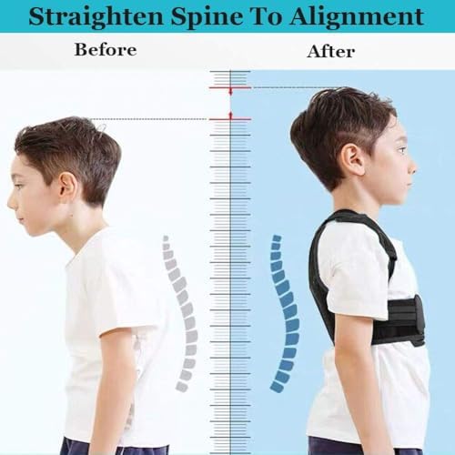 Lexniush Professional Posture Corrector for Kids and Teens, Effective Upper Back Posture Brace for Teenagers Boys Girls Spinal Support to Improves Slouch, Prevent Humpback, Relieve Back Pain