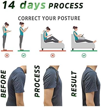 DSMYYXGS Clavicle Spine Physical Adjustable Back Posture Corrector Belt Men Women Home Office Upper Shoulder Posture Correction (Color : J, Size : Medium)