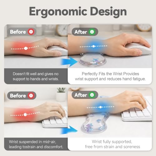 Clear Gel Wrist Rest for Keyboard and Mouse, Ergonomic Non-Slip Silicone Mouse Wrist Rest Set, Soft Comfort for Typing & Gaming Wrist Pain Relief, Fits 60%/68%/75% Keyboards (Sea Animal)