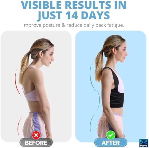 Posture Corrector for Women & Men – Adjustable Back Brace for Alignment, Pain Relief & Back Support – Premium Back Posture Trainer for Improved Posture