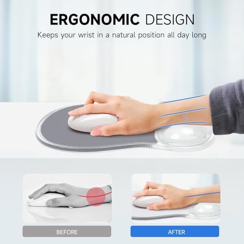 AUPET Ergonomic Mouse Pad with Gel Wrist Support – Non-Slip Mouse Mat with Comfortable Memory Gel Cushion – Relieves Wrist Pain – Designer Pattern for Home Office & Gaming (Dawn Grey)