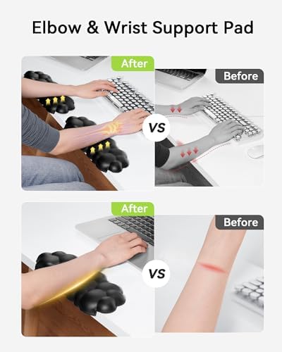 Laborio Elbow Pad for Desk, 2-Pack Cloud Elbow Rest(Black), Edge Arm Rest
