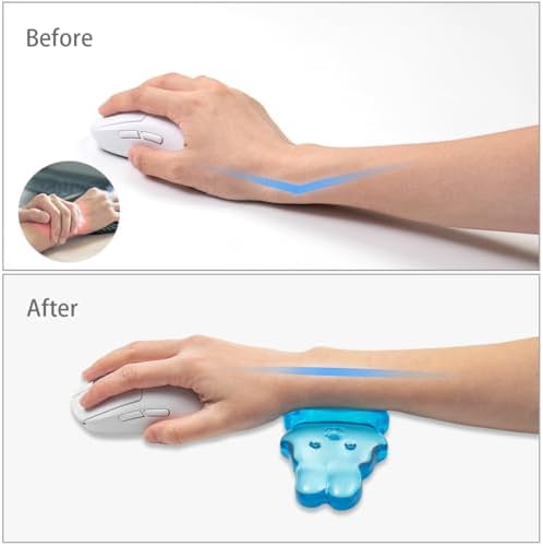 Ergonomic Gel Mouse Wrist Rest,Clear Cute Rabbit Mouse Wrist Rest