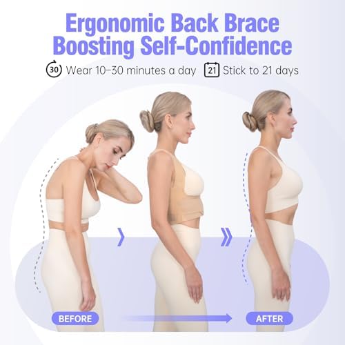 Posture Corrector for Women, Invisible Lightweight Adjustable Back Brace for Neck Shoulder & Upper Back Pain Relief - Improve Posture Correct Scoliosis & Hunchback Under Clothes (Beige, S)