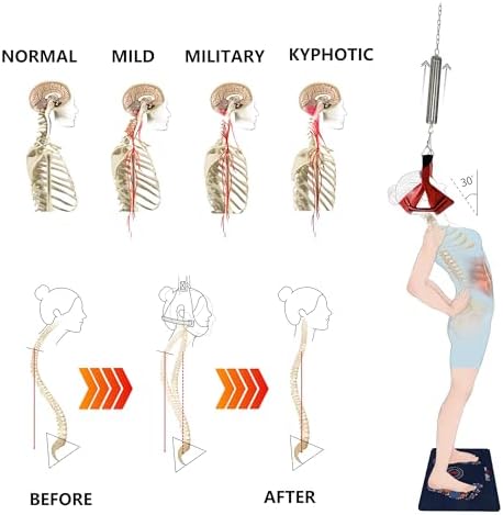 LittleMum Spring-Controlled Cervical Traction System for Home Use-Fabric