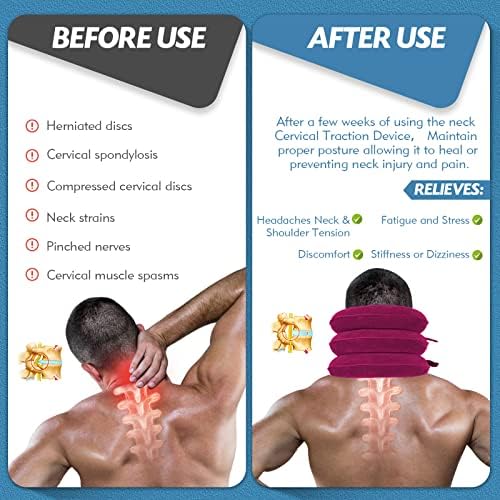 Jaximy Neck Stretcher, Neck Traction Device for Neck Pain Relief (Rose Red)