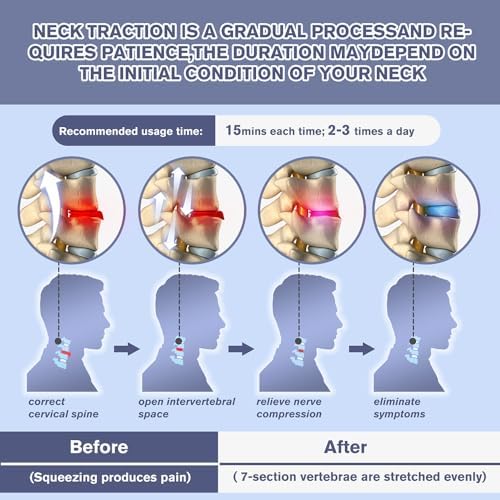 ALPHAY Cervical Neck Traction Device,Electric Air Pump with 3 Power Traction, Built-in 8 Airbag, Neck Pain Relief and Relaxation