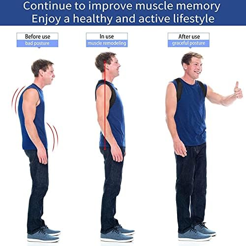 Posture Corrector Upper Back Brace Neck Shoulder Back Support Brace Pain Relief Belt for Women Men Braces Spine Straightener Breathable - Nude