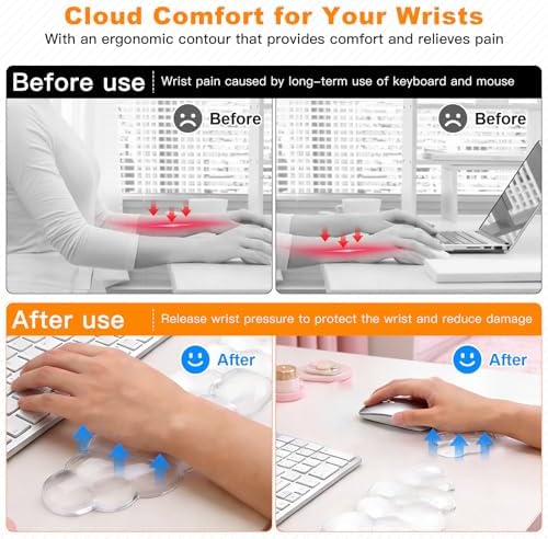 Cloud Keyboard and Mouse Wrist Rest Set, Clear Gel Keyboard Mouse Wrist Rest Support Pad for Typing Pain Relief, Cute Aesthetic Desk Decor Accessory for Home Office Dorm (Clear)