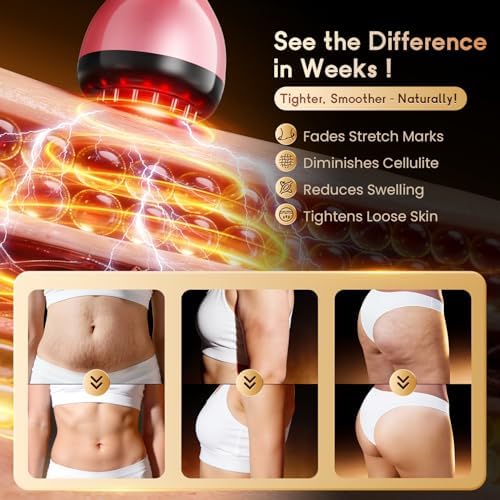 Electric Lymphatic Drainage Massager for Body Anti Cellulite and Thigh