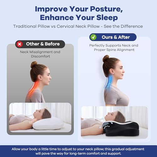 DONAMA Cervical Pillow for Neck Pain, Ergonomic Memory Foam Contour Pillow