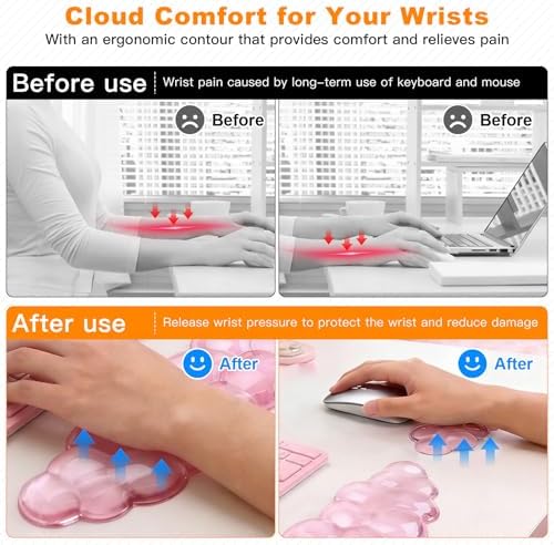 Cloud Keyboard and Mouse Wrist Rest Set, Clear Gel Keyboard Mouse Wrist Rest Support Pad for Typing Pain Relief, Cute Aesthetic Desk Decor Accessory for Home Office Dorm(Pink)