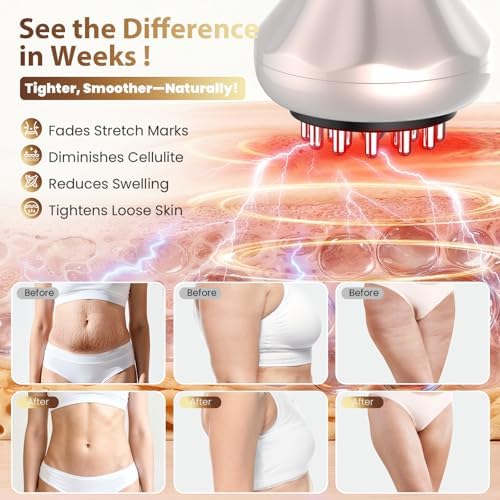 Lymphatic Drainage Massager, Anti Cellulite Massage Tool For Belly & Thigh Stretch Marks & Cellulite Reduction, Handheld Massage tools for Sciatica Nerve, shoulder, Hip, Muscle, Low Back Pain Relief