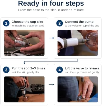 Myofascial Releaser Cupping Set Massager, Cupping Kit for Massage Therapy