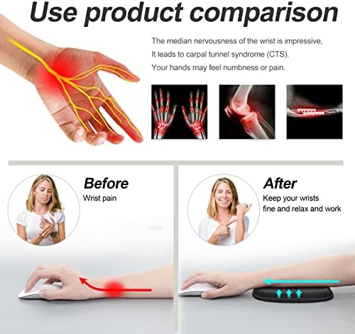 Vaydeer Cloud Elbow Pad, Desk Arm Rest Support, Soft Memory Foam Wrist Rest, Ergonomic Cushion Padding, Carpal Tunnel Pain Relief Gel Mouse Pillow for Computer Laptop Office Gaming Car Chair Accessory