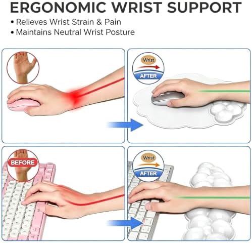Gel Wrist Rest and Cloud Mouse Pad, for Keyboards and Mice - Ergonomic Pink Keyboard Wrist Rest Set, Relieves Pain from Typing/Computer/Laptop/Gaming/Home/Office White