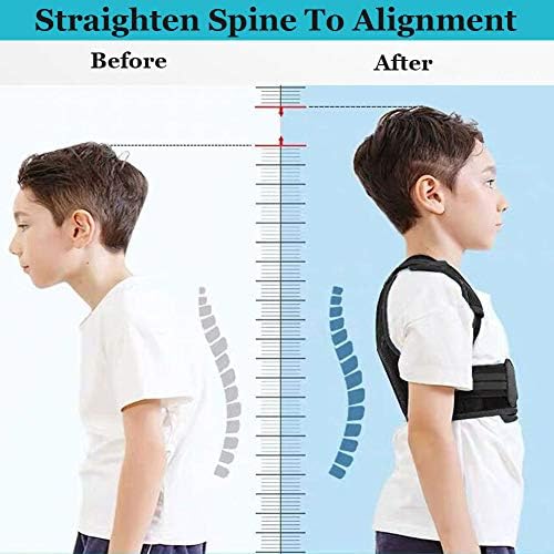 Lexniush Professional Posture Corrector for Men, Women and Kids, Effective Upper Back Posture Brace for Teenagers Boys Girls Spinal Support to Improves Slouch, Prevent Humpback, Relieve Back Pain