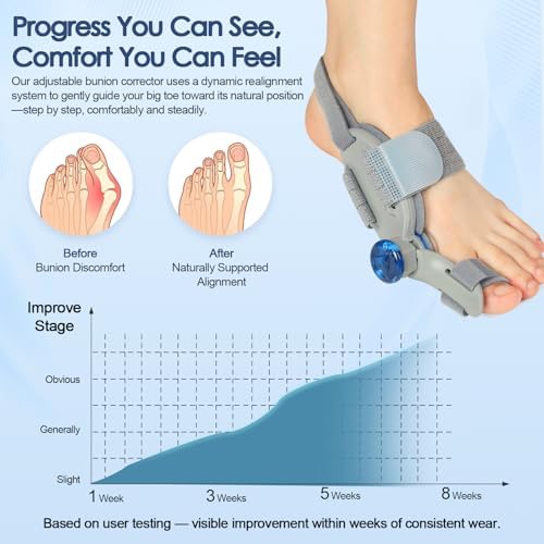 Bunion Corrector for Women Men Big Toe,Adjustable Knob Bunion Corrector for Bunions Relief,Bunioning Fix with Bunioned Silicone Pad,Suitable for Left and Right Feet(2PCS)