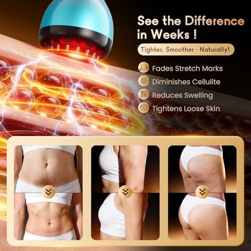 Electric Lymphatic Drainage Massager for Body Anti-Cellulite Sculpting Tool