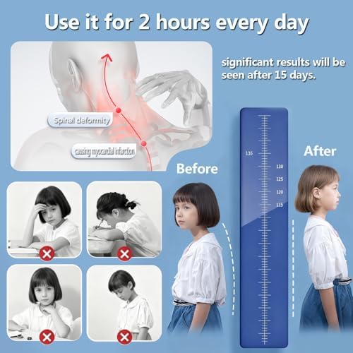 Intelligent Posture Corrector and Trainer for Women and Men, Rechargeable Silicone Automatic Induction Back Posture Corrector with Hunchback Monitoring for Adults and Children
