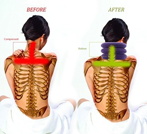 RUNZI Cervical Neck Traction Device Inflatable Neck Stretcher, Easy to Use for Chronic Neck and Shoulder Pain Relief Traction Spine Alignment, Neck Cervical Brace