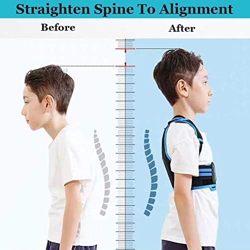 Lexniush Professional Posture Corrector for Men, Women and Kids, Effective Upper Back Posture Brace for Teenagers Boys Girls Spinal Support to Improves Slouch, Prevent Humpback, Relieve Back Pain