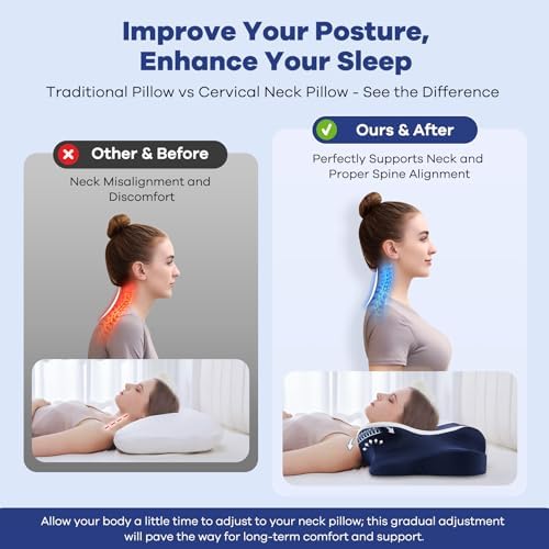 DONAMA Cervical Pillow for Neck Pain, Ergonomic Memory Foam Contour Pillow