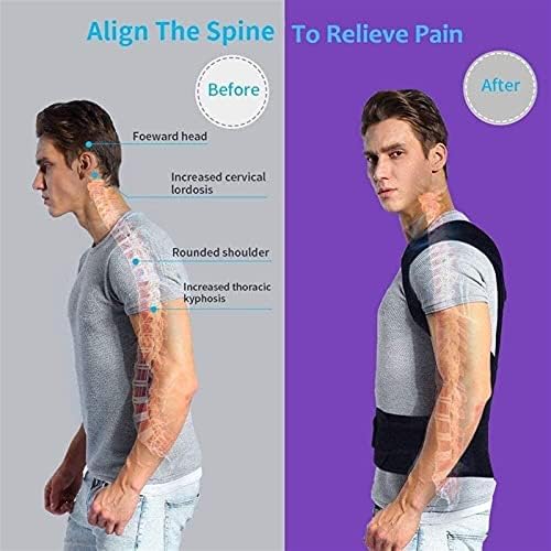 Back Posture Corrector for Men and Women, Anti-kyphosis, Double Adjustable Shoulder Straps and Breathable Mesh Panel to Relieve Back Pain and Stress (Size : Small)