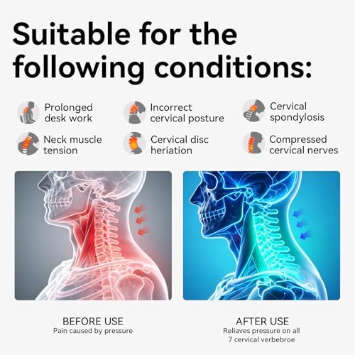 Posture Corrector for Neck & Cervical Spine Alignment - 360° Adjustable Neck Collar with 28 Levels, Memory Foam Support for Pain Relief, Tech Neck, Hump & Forward Head Posture (Gray, Large)