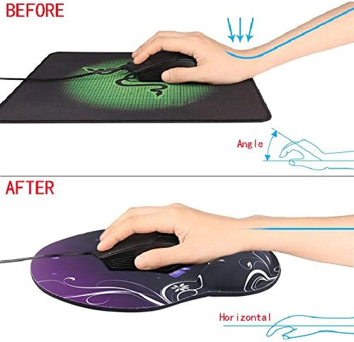 Mouse Pad Wrist Support Ergonomic Mousepad for Desk Laptop