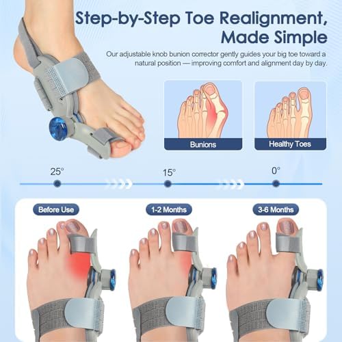 Bunion Corrector for Women Men Big Toe,Adjustable Knob Bunion Corrector for Bunion Relief,Bunion Fix with Bunion Silicone Pad,Suitable for Left and Right Feet(1PCS)