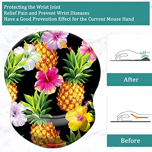 Mouse Pad with Ergonomic Gel-Filled Wrist Rest and Non-Slip PU Base, Comfortable & Accurate Computer Mouse Pad with Support for Home Office Working Studying (Pineapple)