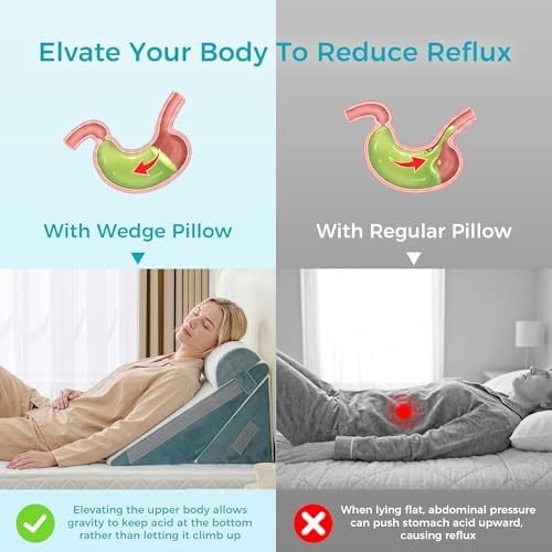 BDEUS 3PCS Wedge Pillow Set for After Surgery, Back Pillow for Bed Sitting up, Orthopedic Foam Wedge Pillow for Acid Reflux Sleep Apnea Back Pain Relief, Post Surgery Pillow for GERD & Snoring, Navy